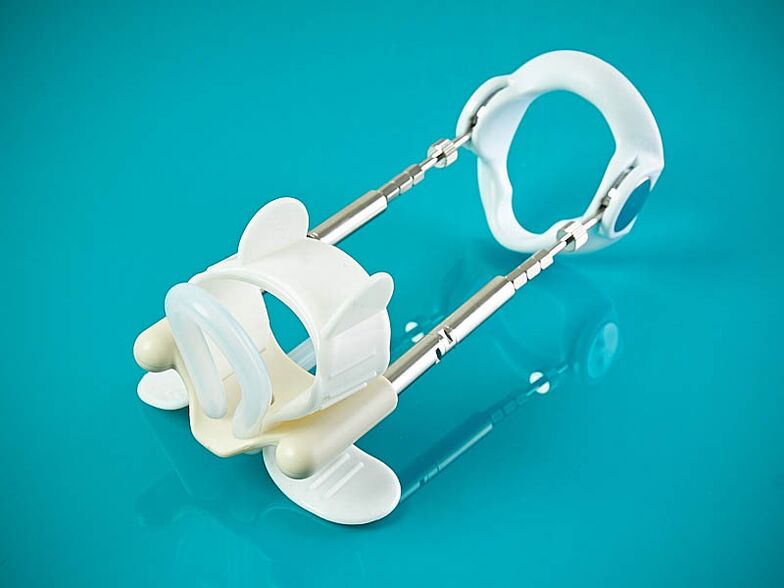 Hybrid extender for a member